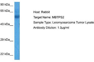 Host:  Rabbit  Target Name:  MBTPS2  Sample Tissue:  Human Leiomyosarcoma Tumor lysates  Antibody Dilution:  1ug/ml (MBTPS2 antibody  (N-Term))
