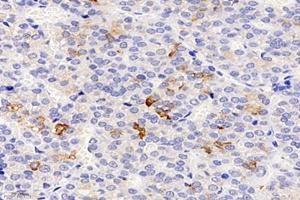 Immunohistochemistry analysis of paraffin-embedded rat pituitary using,CHST8 (ABIN7073301) at dilution of 1: 3000 (CHST8 antibody)