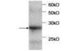 Image no. 1 for anti-serpin Peptidase Inhibitor, Clade B (Ovalbumin), Member 4 (SERPINB4) antibody (ABIN791514) (SERPINB4 antibody)