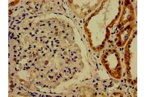 Immunohistochemistry of paraffin-embedded human kidney tissue using ABIN7148855 at dilution of 1:100 (CDK13 antibody  (AA 1-170))