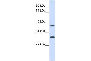 FAM156A antibody used at 1 ug/ml to detect target protein. (FAM156A antibody  (N-Term))