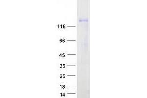 Western Blotting (WB) image for Sema Domain, Seven thrombospondin Repeats (Type 1 and Type 1-Like), Transmembrane Domain (TM) and Short Cytoplasmic Domain, (Semaphorin) 5A (SEMA5A) protein (Myc-DYKDDDDK Tag) (ABIN2731628)