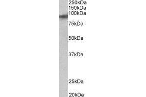 Western Blotting (WB) image for anti-Zinc Finger Protein 652 (ZNF652) (C-Term) antibody (ABIN2464976) (ZNF652 antibody  (C-Term))