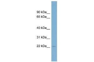 C15ORF15 antibody used at 1 ug/ml to detect target protein. (RSL24D1 antibody  (Middle Region))
