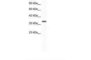Image no. 1 for anti-Aryl Hydrocarbon Receptor Interacting Protein (AIP) (AA 99-148) antibody (ABIN202263) (AIP antibody  (AA 99-148))