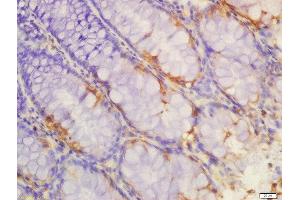 Formalin-fixed and paraffin embedded rat colon labeled with Anti-IL-1R2 Polyclonal Antibody, Unconjugated  at 1:200 followed by conjugation to the secondary antibody and DAB staining (IL1R2 antibody  (AA 301-398))