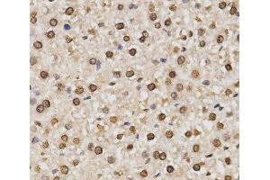 Immunohistochemistry of paraffin-embedded Rat liver using DiMethyl-Histone H3-K14 Polyclonal Antibody at dilution of 1:200 (40x lens). (Histone 3 antibody  (2meLys14))