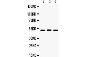 Western Blotting (WB) image for anti-Bone Morphogenetic Protein 5 (BMP5) (AA 332-365), (C-Term) antibody (ABIN3043800) (BMP5 antibody  (C-Term))