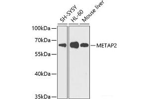 Western blot analysis of extracts of various cell lines using METAP2 Polyclonal Antibody at dilution of 1:1000. (METAP2 antibody)