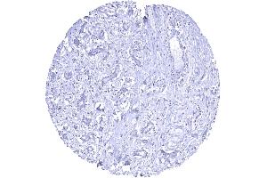 Breast HER2 staining is lacking in normal breast in case of appropriate formalin fixation (Recombinant ErbB2/Her2 antibody  (Extracellular Domain))