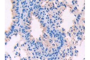 Used in DAB staining on fromalin fixed paraffin- embedded pancreas tissue (SFTPD antibody  (AA 259-374))