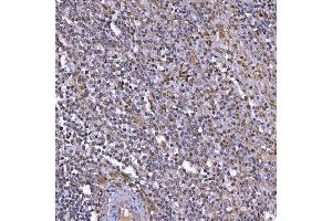 IHC analysis of TOP3B using anti-TOP3B antibody (ABIN7599907).