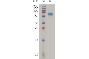 Human LTBR Protein, hFc Tag on SDS-PAGE under reducing condition.