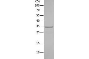 Western Blotting (WB) image for Janus Kinase 2 (JAK2) (AA 241-351) protein (His-IF2DI Tag) (ABIN7123645) (JAK2 Protein (AA 241-351) (His-IF2DI Tag))