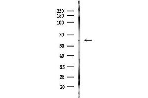 Western blot analysis of lysates from Hela cells(heat-shock,45 min treatment), using MKRN1 Antibody at 1/1000 dilution.