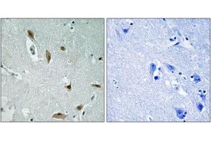 Immunohistochemical staining of paraffin-embedded human brain tissue reacted with AKT1/AKT3 (phospho Y437/Y434) polyclonal antibody  at 1:50-1:100 dilution. (AKT1/3 (pTyr437), (Tyr434) antibody)