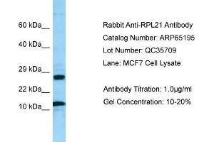 Western Blotting (WB) image for anti-Ribosomal Protein L21 (RPL21) (Middle Region) antibody (ABIN2790073) (RPL21 antibody  (Middle Region))