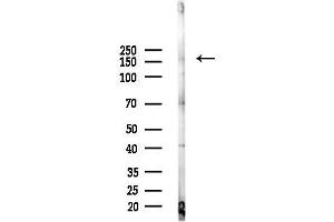 Western blot analysis of lysates from Rat brain, using RGAP2 Antibody at 1/1000 dilution.