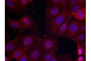 Immunofluorescence staining of methanol-fixed MCF cells using Estrogen Receptor-a(Phospho-Ser167) Antibody. (Estrogen Receptor alpha antibody  (pSer167))