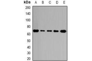 Western blot analysis of GalNAc-T2 expression in HepG2 (A), A431 (B), mouse lung (C), rat kidney (D), rat brain (E) whole cell lysates. (GalNAc-T2 antibody)