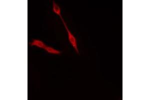 ABIN6274372 staining Hela cells by IF/ICC. (TRIP4 antibody  (N-Term))
