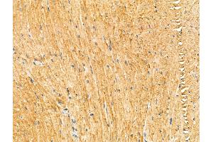 ABIN7094321 and ABIN7098368 at 1/100 staining Mouse heart tissue by IHC-P. (KIF19 antibody  (Internal Region))