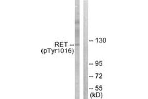 Western blot analysis of extracts from COS7 cells treated with EGF 200ng/ml 30', using Ret (Phospho-Tyr1015) Antibody. (Ret Proto-Oncogene antibody  (pTyr1015))