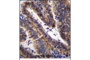 LRRN4CL Antibody (Center) (ABIN656629 and ABIN2845875) immunohistochemistry analysis in formalin fixed and paraffin embedded human uterus tissue followed by peroxidase conjugation of the secondary antibody and DAB staining. (LRRN4CL antibody  (AA 117-146))