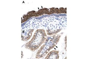 Immunohistochemical staining (Formalin-fixed paraffin-embedded sections) of human spermatophore (A) and human intestine (B) with AEBP1 polyclonal antibody  at 4-8 ug/mL working concentration.