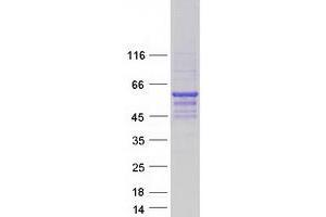 Western Blotting (WB) image for Septin 9 (SEPT9) (Transcript Variant 7) protein (Myc-DYKDDDDK Tag) (ABIN2731699)