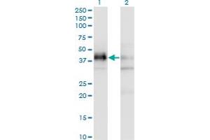 Western Blot analysis of SFRS5 expression in transfected 293T cell line by SFRS5 monoclonal antibody (M03A), clone 2C8.