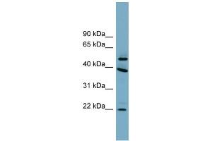 WB Suggested Anti-C4orf20 Antibody Titration: 0. (UFSP2 antibody  (Middle Region))