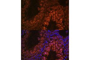 Immunofluorescence analysis of mouse testis using UBQLN3 antibody (ABIN7271123) at dilution of 1:100. (Ubiquilin 3 antibody  (AA 306-620))