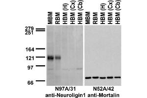 Immunoblot against crude membranes from whole mouse (MBM) or rat (RBM) brain and from human hippocampus [HBM(H)], cerebral cortex [HBM(Cx)] or cerebellum [HBM(Cb)] probed with N97A/31 (left) or N52A/42 (right) TC supe. (Neuroligin 1 antibody  (C-Term, Intracellular))