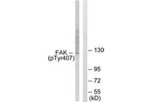 Western blot analysis of extracts from COS7 cells treated with EGF 200ng/ml 30', using FAK (Phospho-Tyr407) Antibody. (FAK antibody  (pTyr407))