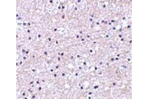 Immunohistochemistry of IEX-1 in human liver tissue with IEX-1 antibody at 2. (IER3 antibody  (Center))