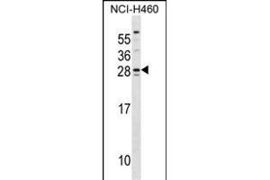 SH3BGR Antibody (Center) (ABIN1537875 and ABIN2848568) western blot analysis in NCI- cell line lysates (35 μg/lane). (SH3BGR antibody  (AA 149-177))