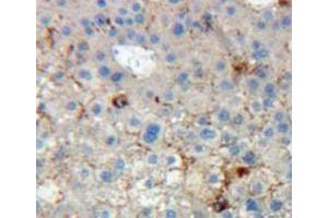 Used in DAB staining on fromalin fixed paraffin-embedded liver tissue (KIR2DL5A antibody  (AA 22-375))