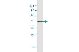 Western Blot detection against Immunogen (37. (RLF antibody  (AA 1805-1913))