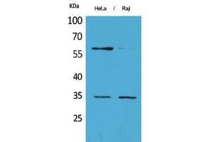 Western Blotting (WB) image for anti-Fc gamma RII (CD32) (C-Term) antibody (ABIN3187677) (Fc gamma RII (CD32) (C-Term) antibody)