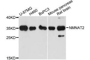Western blot analysis of extracts of various cell lines, using NMNAT2 antibody (ABIN6291178) at 1:3000 dilution. (NMNAT2 antibody)