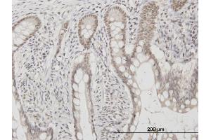 Immunostaining (ISt) image for anti-C1D Nuclear Receptor Corepressor (C1D) (AA 1-141) antibody (ABIN564544)