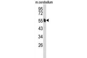 Western Blotting (WB) image for anti-Membrane Protein, Palmitoylated 6 (MAGUK P55 Subfamily Member 6) (MPP6) antibody (ABIN3004081) (MPP6 antibody)