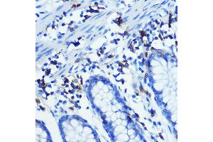Immunohistochemistry of paraffin-embedded human colon using CD3H Rabbit mAb (ABIN7266174) at dilution of 1:100 (40x lens). (CD247 antibody)