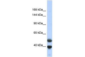 Host:  Rabbit  Target Name:  PRDM7  Sample Type:  Fetal Lung lysates  Antibody Dilution:  1. (PRDM7 antibody  (N-Term))