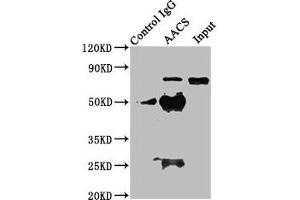 Immunoprecipitating AACS in HEK293 whole cell lysate Lane 1: Rabbit control IgG instead of ABIN7142936 in HEK293 whole cell lysate. (AACS antibody  (AA 435-598))