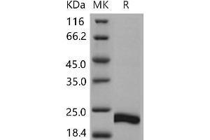Western Blotting (WB) image for Cysteine and Glycine-Rich Protein 1 (CSRP1) protein (His tag) (ABIN7320243) (CSRP1 Protein (His tag))