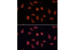 Immunofluorescence analysis of L929 cells using KCN antibody (ABIN7269481) at dilution of 1:100. (KCNAB2 antibody  (AA 1-40))