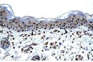 Human Skin; ZNFN1A5 antibody - N-terminal region in Human Skin cells using Immunohistochemistry (IKZF5 antibody  (N-Term))