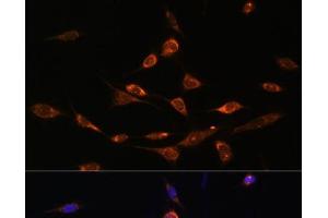 Immunofluorescence analysis of NIH-3T3 cells using PAK3 Polyclonal Antibody at dilution of 1:100.